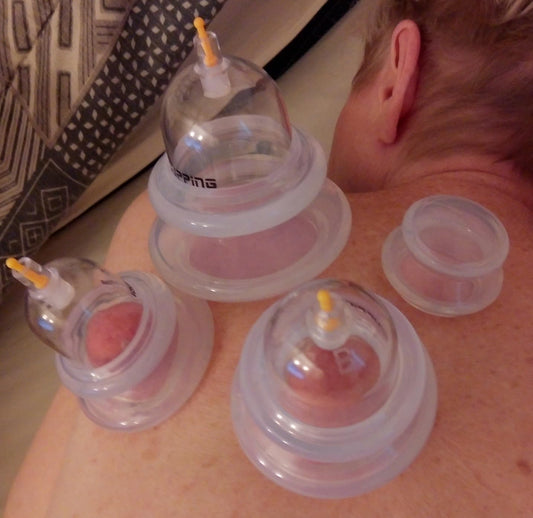What Real Users Say After Trying a Hybrid Cupping Therapy Set