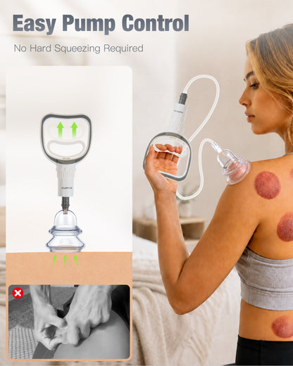 CUVIA Hybrid Vacuum Cupping Set